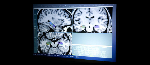 Neuroscienziati o neurodeliri? Neuroimmaging