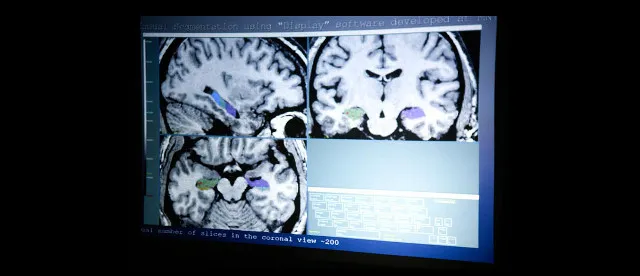 Neuroscienziati o neurodeliri? Neuroimmaging